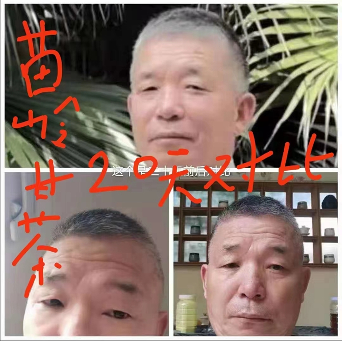 高級(jí)反射蜂療專家范景良 高級(jí)反射蜂療專家范景良
